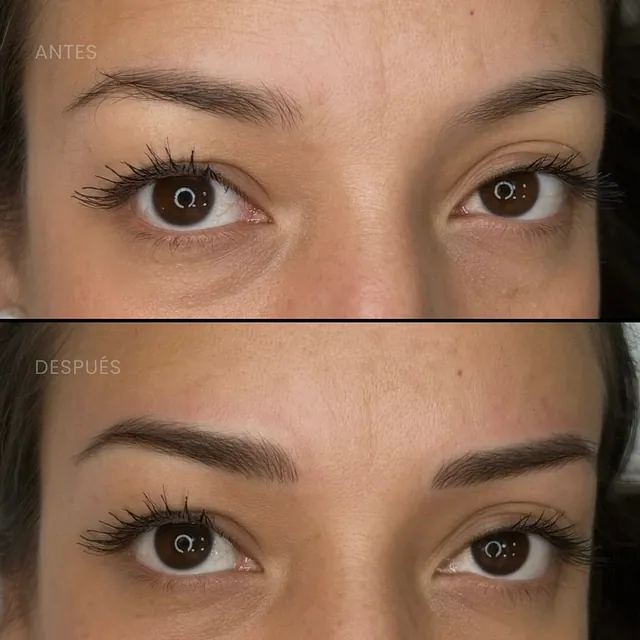 antes y después de un rostro de una chica