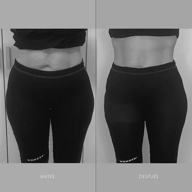 antes y después de chica