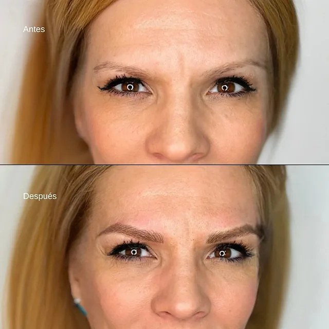 antes y después de un rostro de una chica