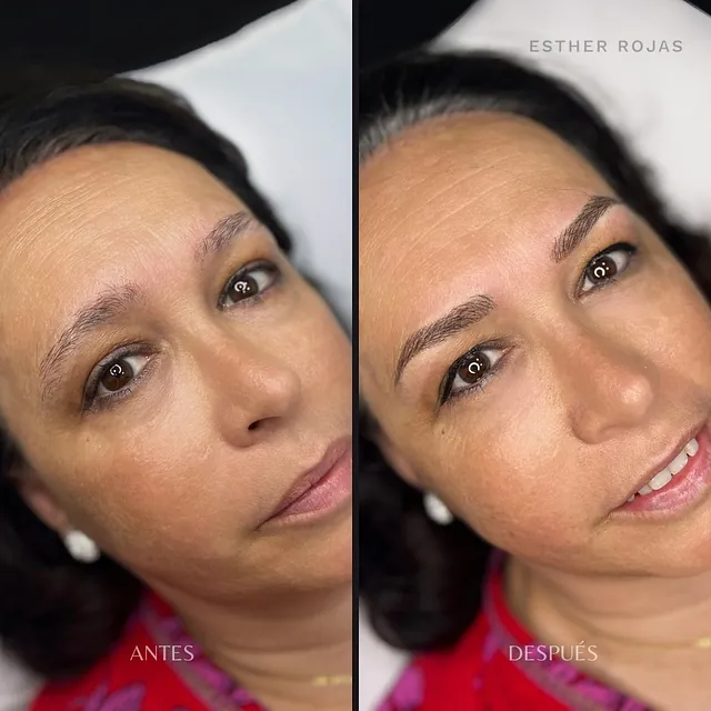 antes y después de un rostro de una chica