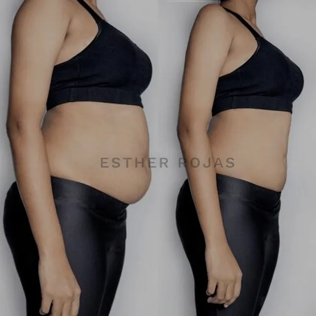 antes y después de chica