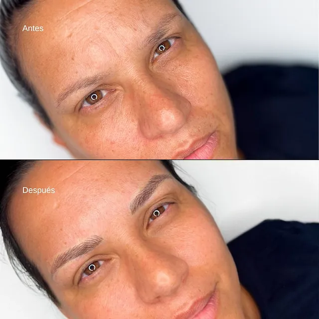 antes y después de un rostro de una chica