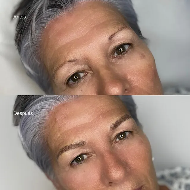 antes y después de un rostro de una señora